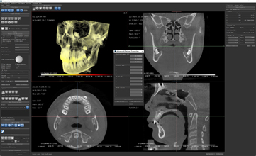 医学图像三维可视化和分析软件